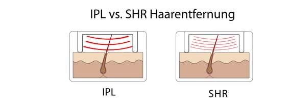 ipl shr vergleich frankfurt e1675865725680