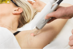 ND:YAG-Laser Frankfurt​